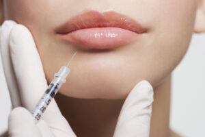 Mehr über den Artikel erfahren Lippenfiller in Recklinghausen – warum aufgespritzte Lippen nicht gleich Schlauchboot-Lippen sind