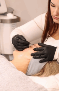 Mehr über den Artikel erfahren Dermaplaning – warum Gesichtsrasierer aus der Drogerie deiner Haut mehr schaden als helfen