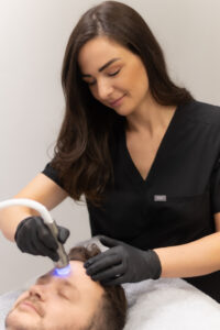 Mehr über den Artikel erfahren Medizinisches Microneedling in Recklinghausen – strahlende Haut durch sanfte Therapie