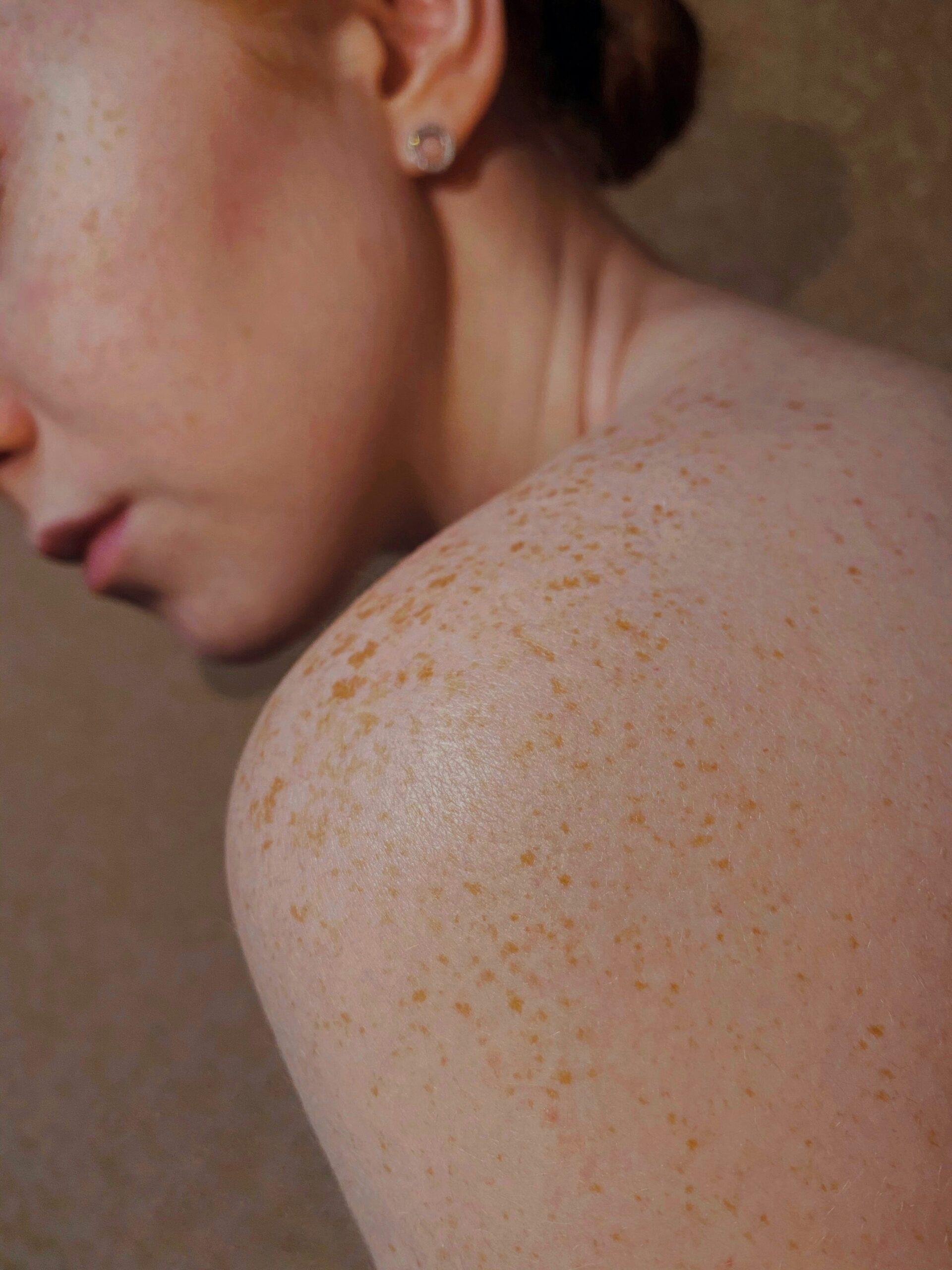Mehr über den Artikel erfahren Welche ästhetischen Behandlungen sind im Sommer möglich? ☀️
