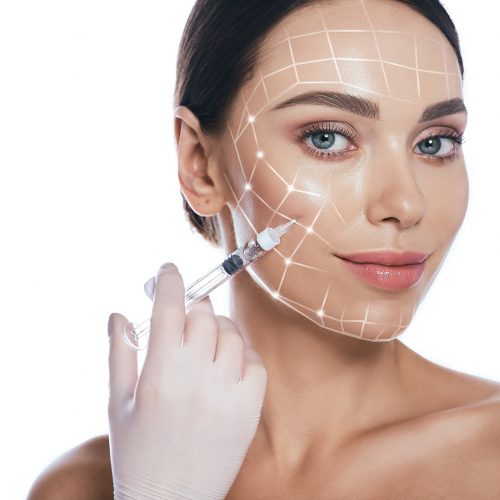 Woman face with lifting lines on skin, showing filler injections for lift skin, cheeks and chin. Anti-aging treatment