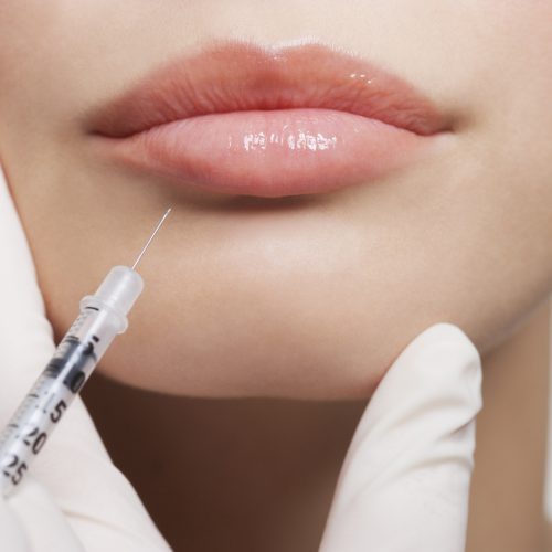 Close up of woman receiving botox injection in lips